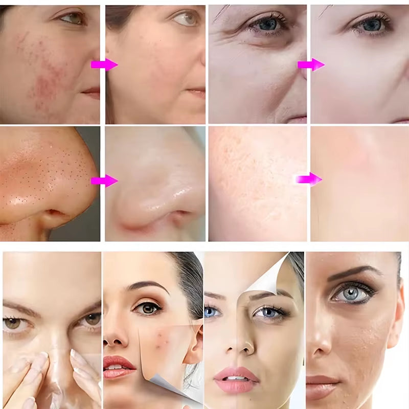 Facial Machine Oxygenation Oxygen Facial Machine Hydra Diamond Oxygen Bubble Facial Beauty Machine
